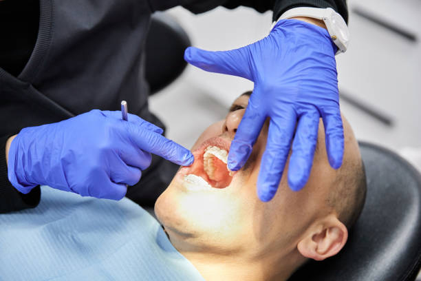 Best Emergency Dentist for Lost Fillings or Crowns in Del Rio, TX